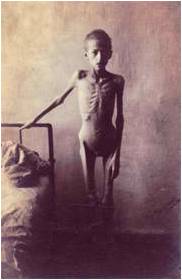 Holodomor Starved Child
